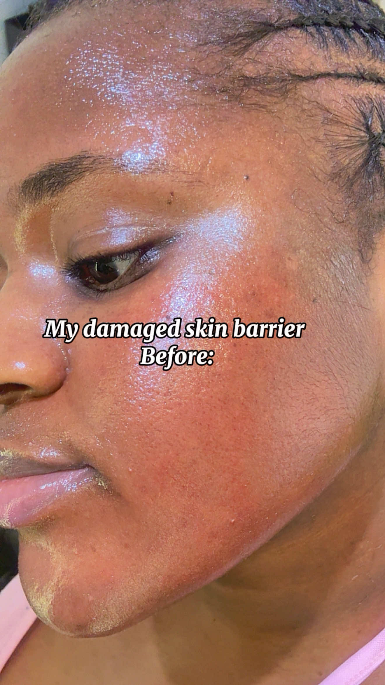 Start with the skin concern.